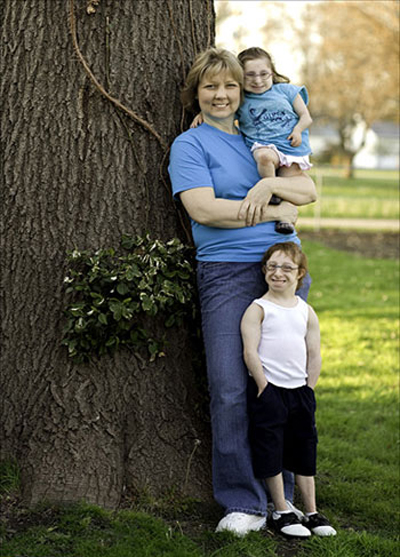 عجیب ترین خواهر و برادر 22 و 20 ساله جهان +عکس