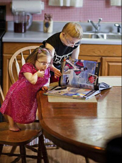 عجیب ترین خواهر و برادر 22 و 20 ساله جهان +عکس