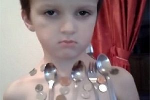 خبر جدید؛ بدن این پسر خاصیت جذب آهن دارد (عکی) بدن این پسر خاصیت جذب آهن دارد (عکی)