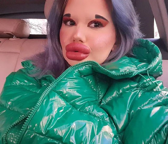 دختر 24 ساله با بزرگ ترین لب های جهان و اندامی عجیب + عکس