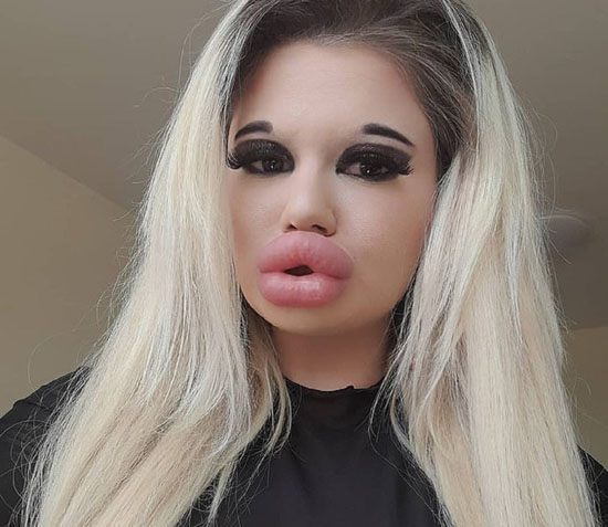 دختر 24 ساله با بزرگ ترین لب های جهان و اندامی عجیب + عکس