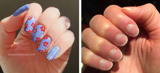 ریشه ناخن ها ، کارهای عجیب بدن انسان