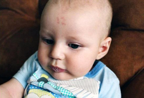 حک شدن عجیب عدد 12 بر روی پیشانی این نوزاد (عکس)