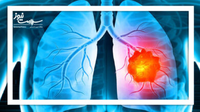این خوراکی ها احتمال ابتلا به سرطان ریه را افزایش می دهند این خوراکی ها احتمال ابتلا به سرطان ریه را افزایش می دهند