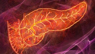 کشف یک نوع متمایز و جدید از بیماری دیابت