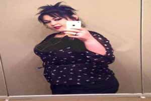 اندام دیدنی دختر 470 کیلویی پس از لاغری (عکس)