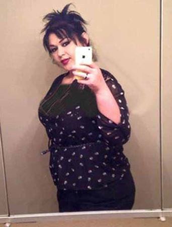 اندام دیدنی دختر 470 کیلویی پس از لاغری (عکس)