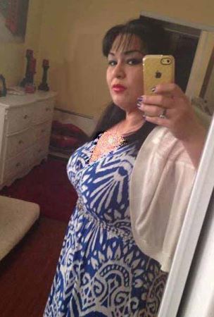 اندام دیدنی دختر 470 کیلویی پس از لاغری (عکس)