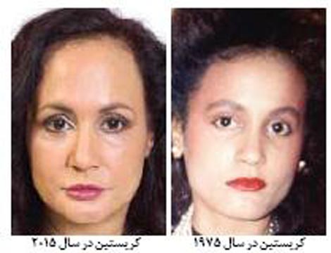 جلوگیری از پیری به روش عجیب خانم آمریکایی (عکس) جلوگیری از پیری به روش عجیب خانم آمریکایی (عکس)