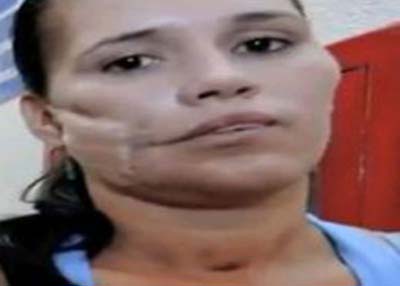 خارج کردن نارنجک منفجر نشده از صورت زنی +عکس