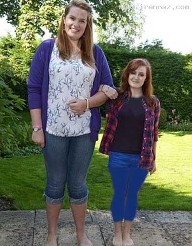 این دختر 19 ساله پا گنده ترین دختر دنیا شد! +عکس این دختر 19 ساله پا گنده ترین دختر دنیا شد! +عکس