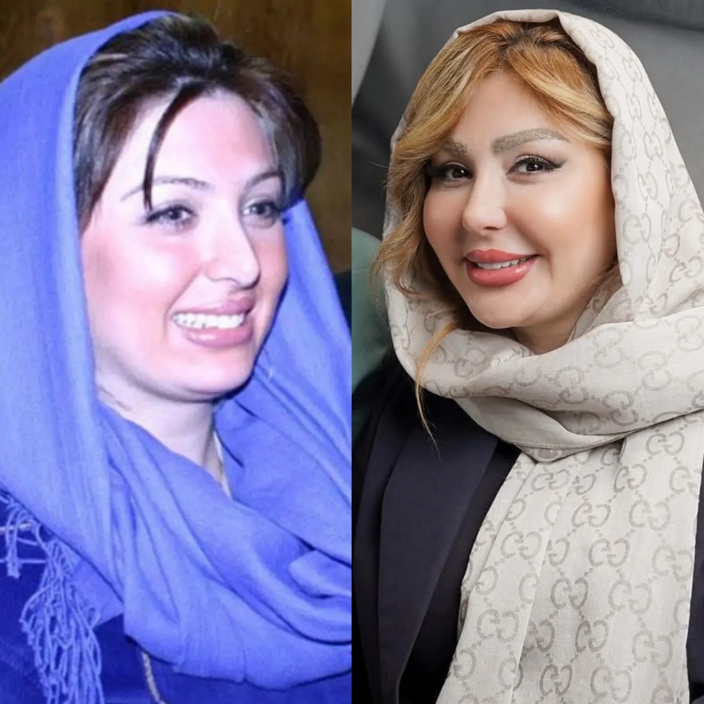 تغییرات جنجالی چهره خانم نیوشا ضیغمی در ۴۵سالگی