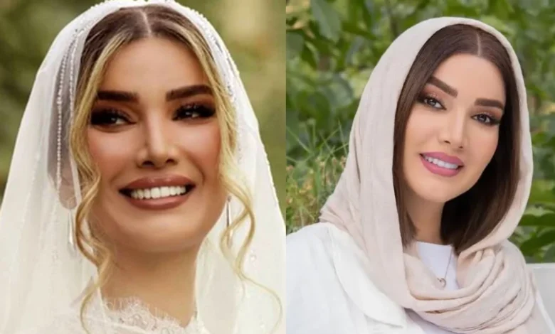 تصویر دیدنی متین ستوده قبل و بعد از آرایش!
