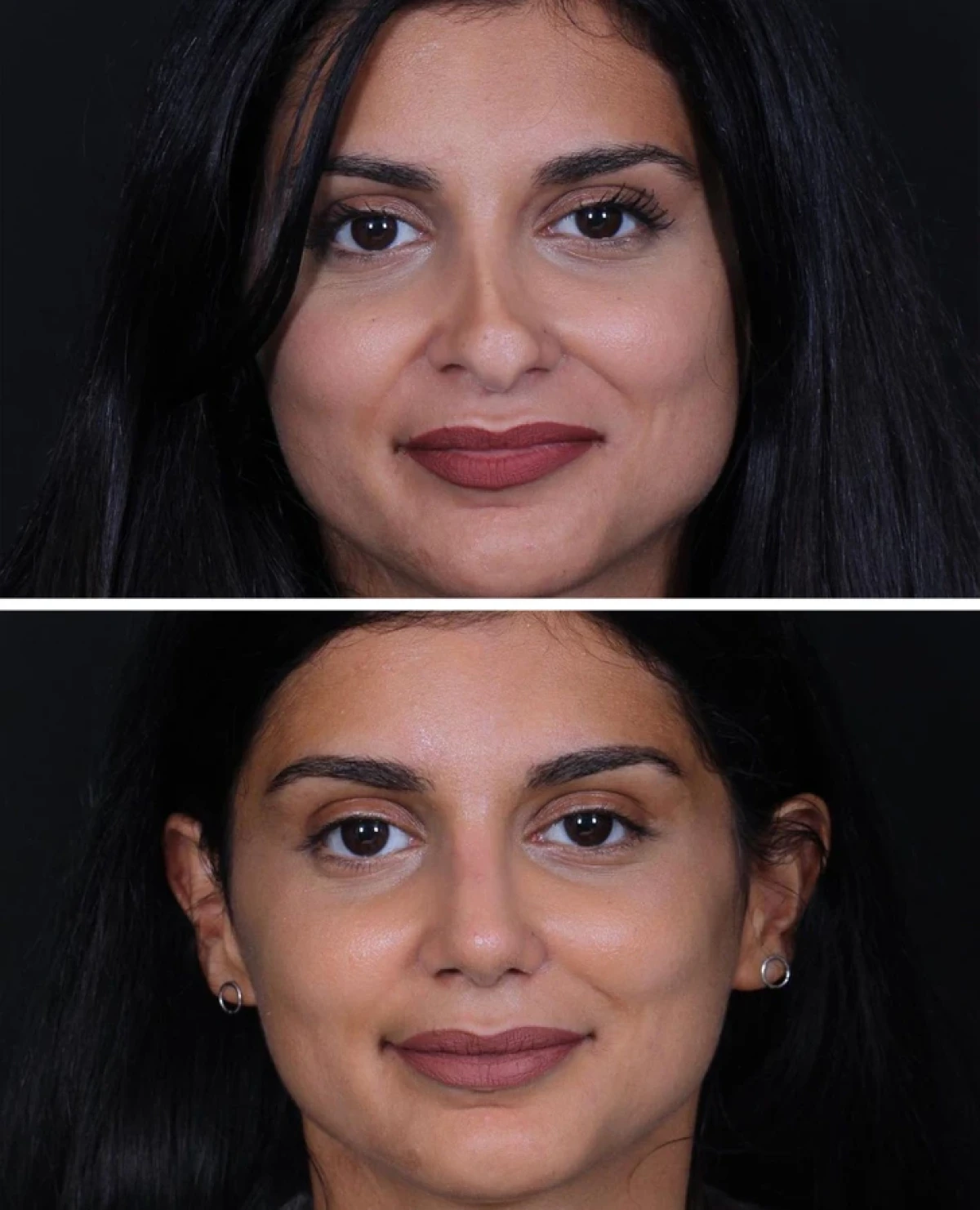 تاریخ عکس گردی| نتیجه ۲۰ جراحی که این زنان را به آرزویشان رساند