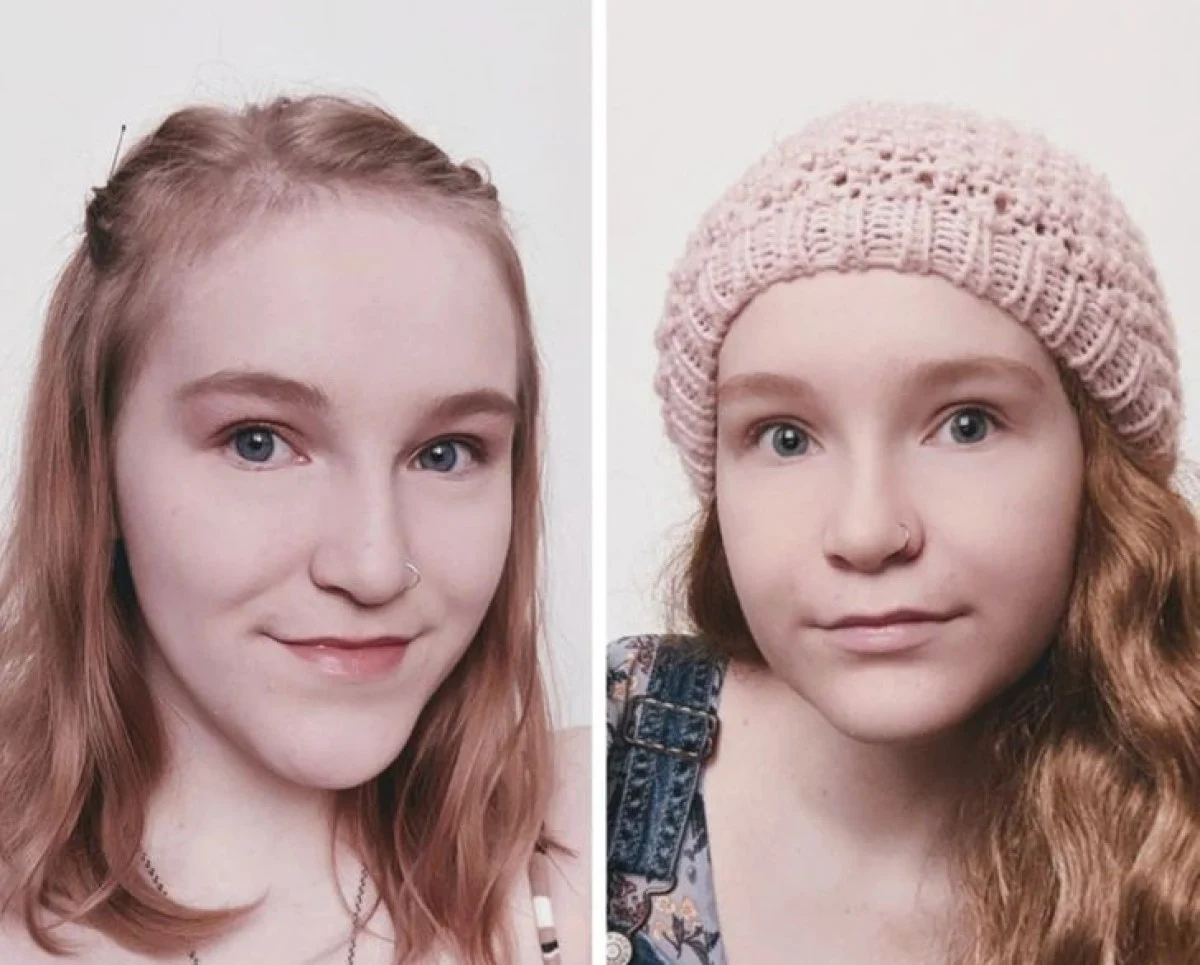 تاریخ عکس گردی| نتیجه ۲۰ جراحی که این زنان را به آرزویشان رساند