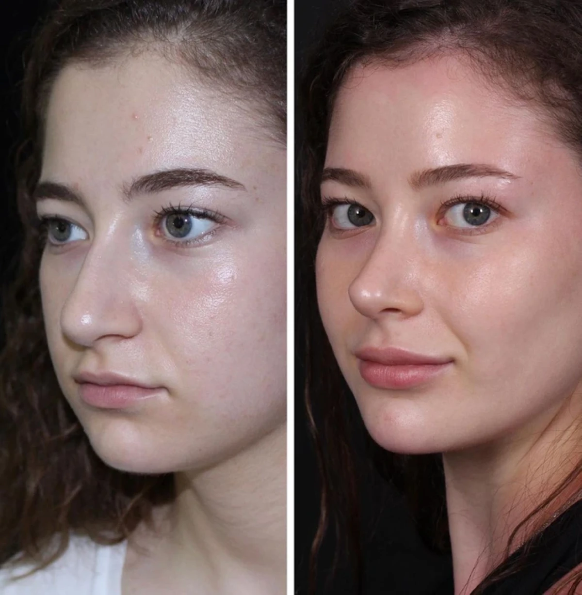 تاریخ عکس گردی| نتیجه ۲۰ جراحی که این زنان را به آرزویشان رساند