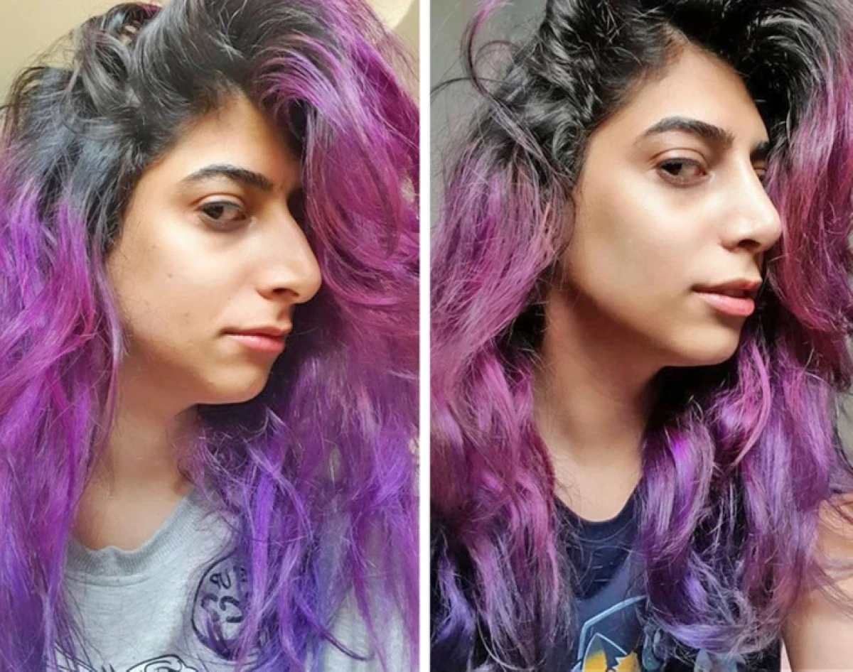 تاریخ عکس گردی| نتیجه ۲۰ جراحی که این زنان را به آرزویشان رساند