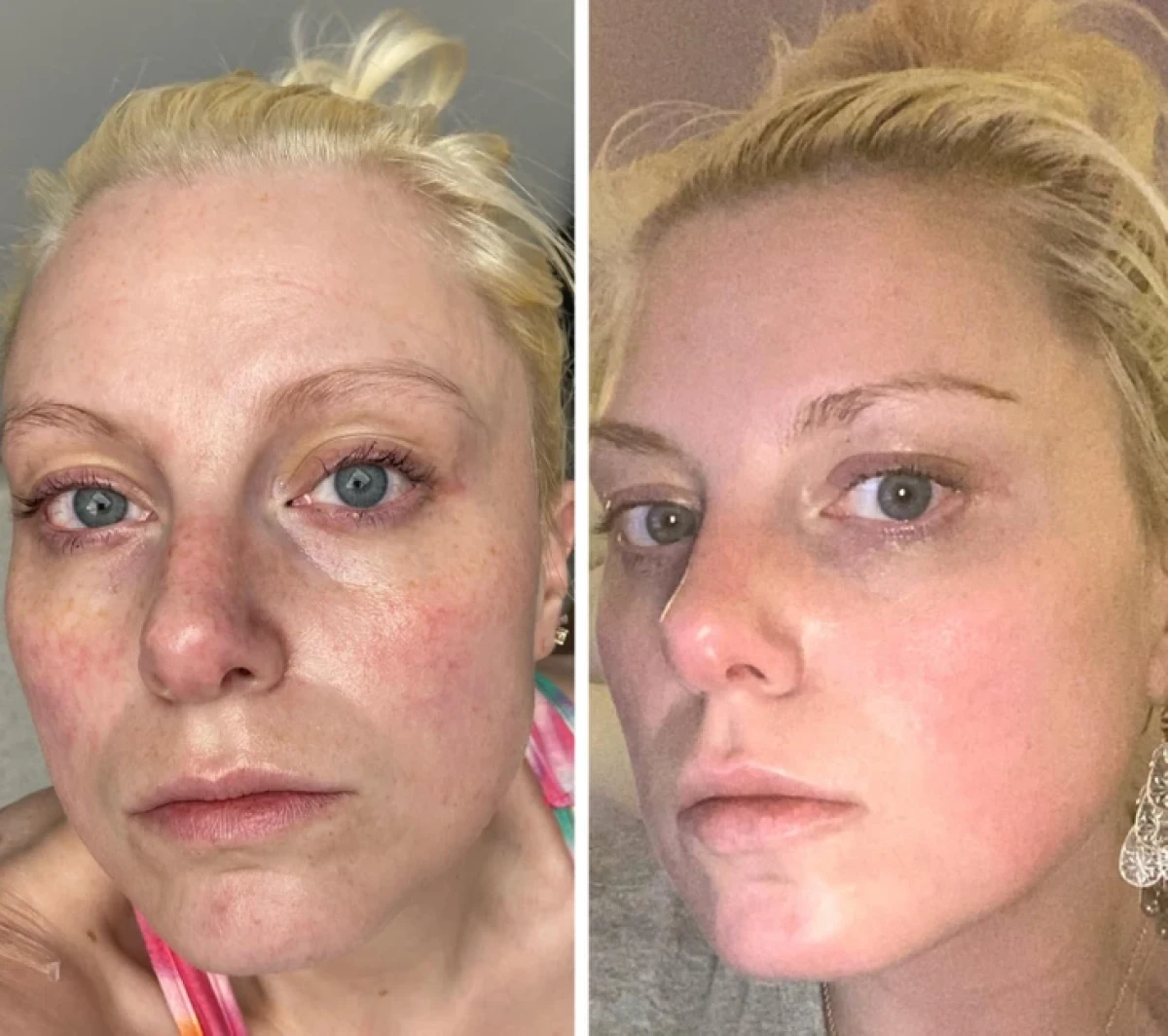 تاریخ عکس گردی| نتیجه ۲۰ جراحی که این زنان را به آرزویشان رساند