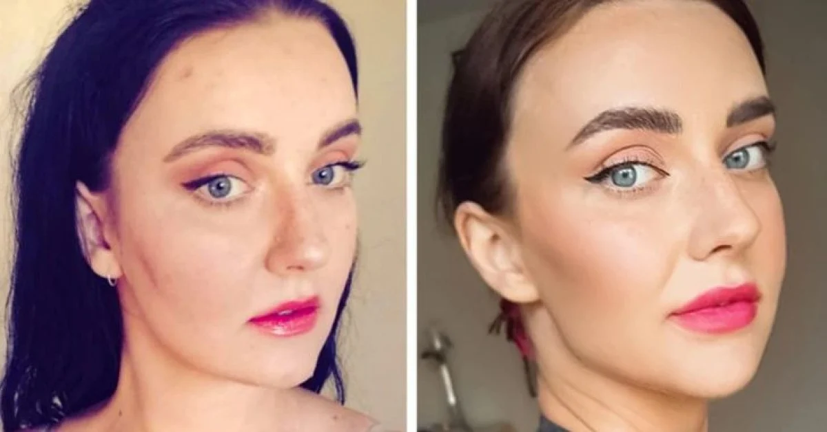 تاریخ عکس گردی| نتیجه ۲۰ جراحی که این زنان را به آرزویشان رساند