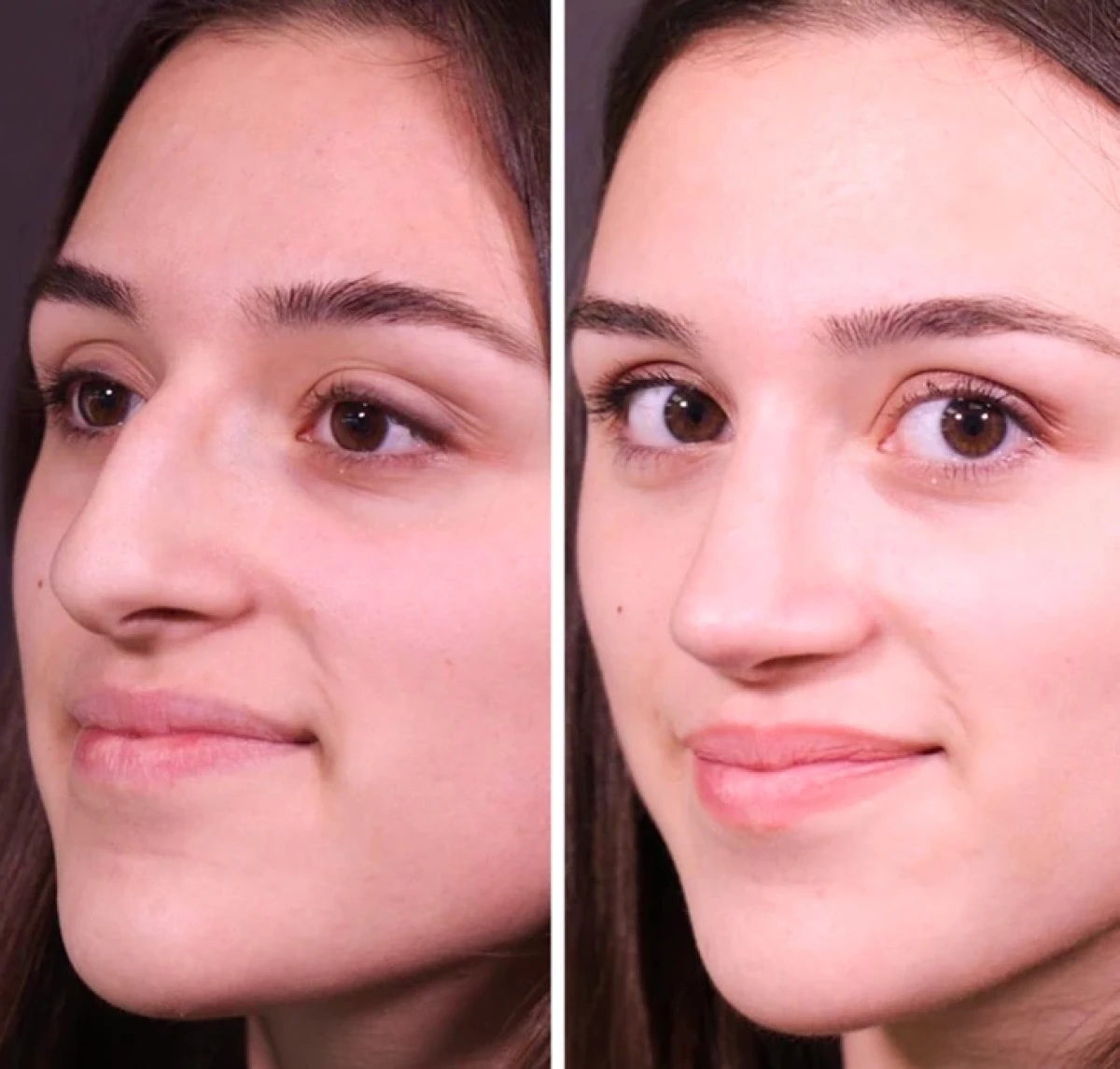 تاریخ عکس گردی| نتیجه ۲۰ جراحی که این زنان را به آرزویشان رساند