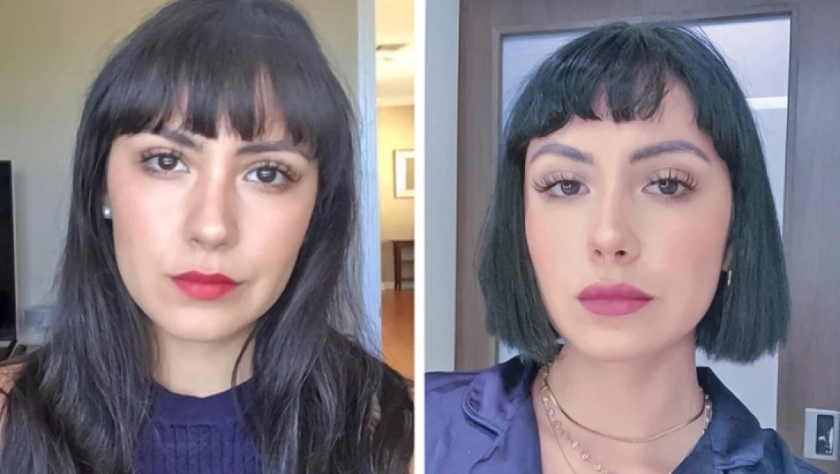 تاریخ عکس گردی| نتیجه ۲۰ جراحی که این زنان را به آرزویشان رساند