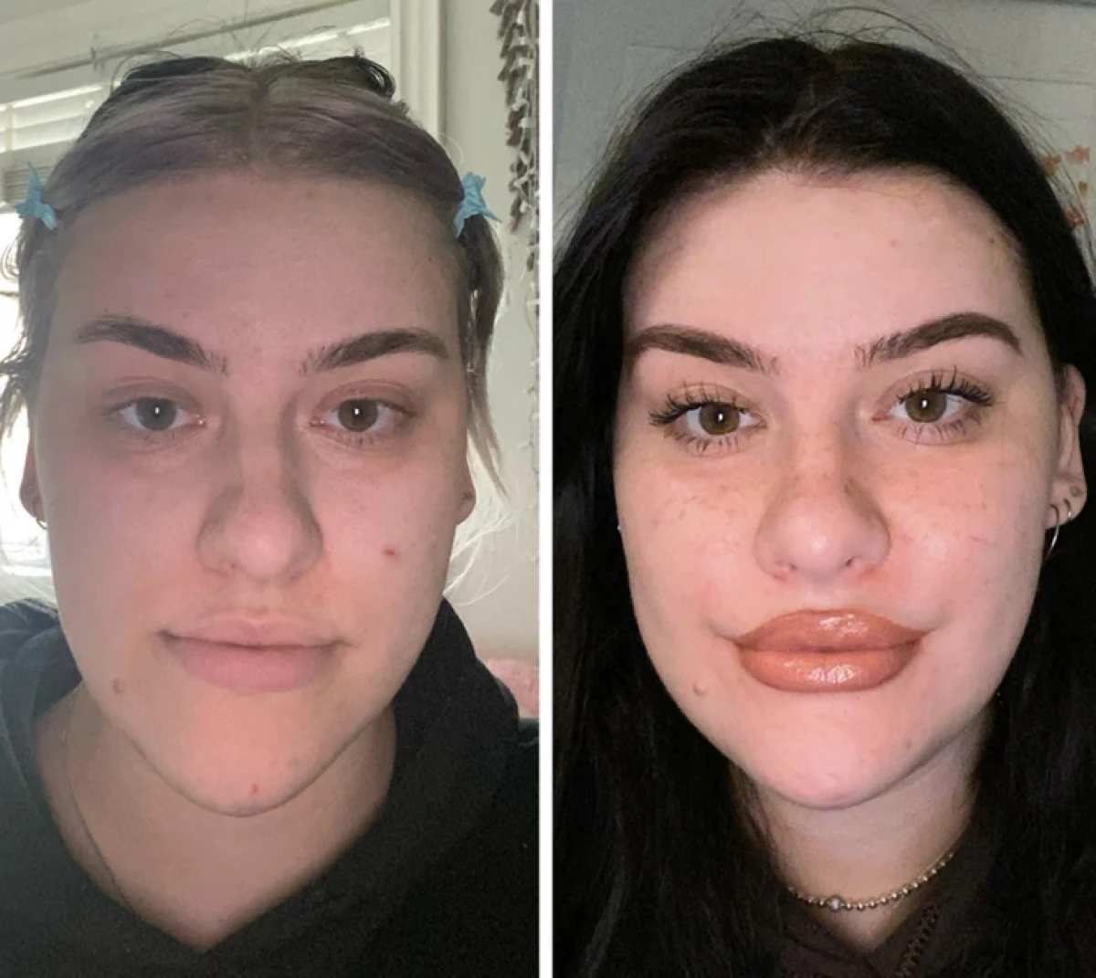 تاریخ عکس گردی| نتیجه ۲۰ جراحی که این زنان را به آرزویشان رساند