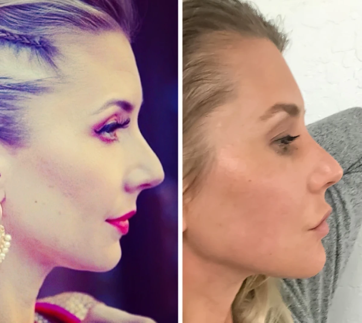 تاریخ عکس گردی| نتیجه ۲۰ جراحی که این زنان را به آرزویشان رساند