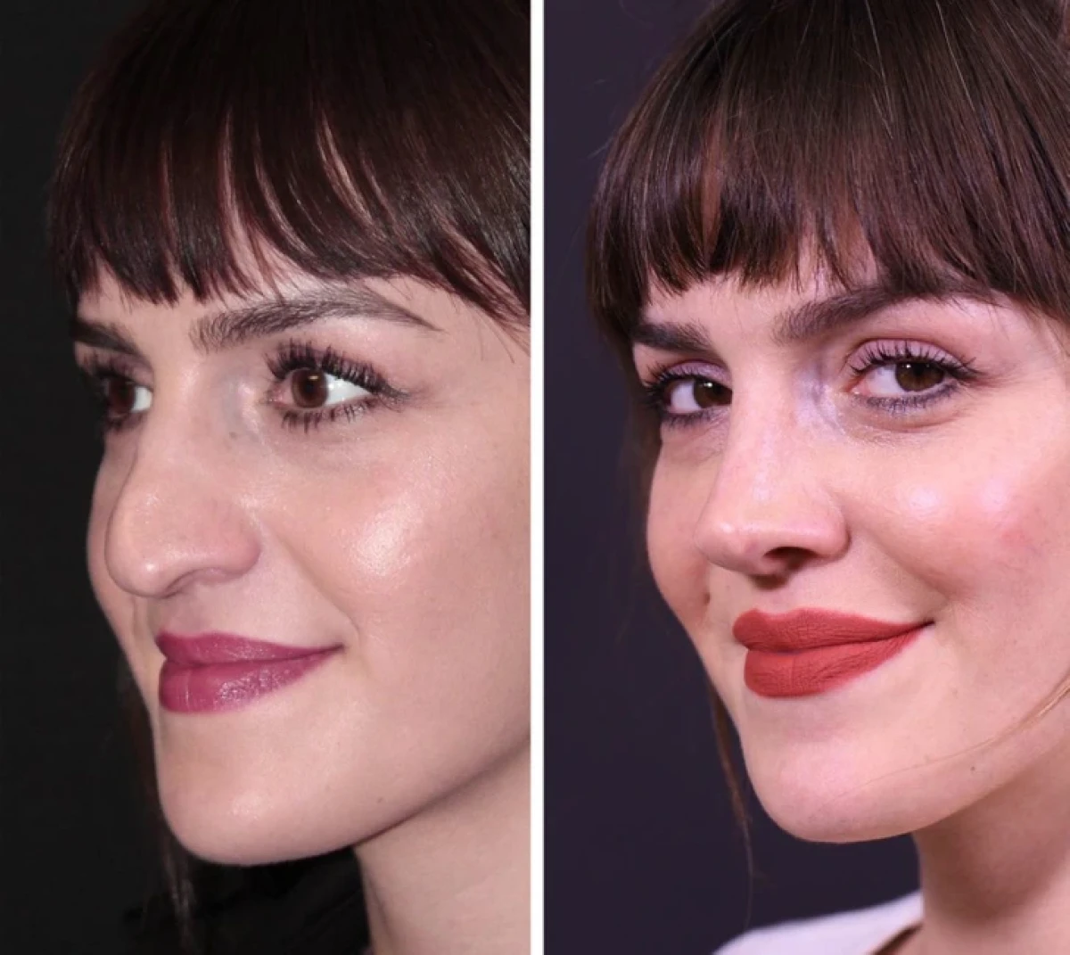 تاریخ عکس گردی| نتیجه ۲۰ جراحی که این زنان را به آرزویشان رساند