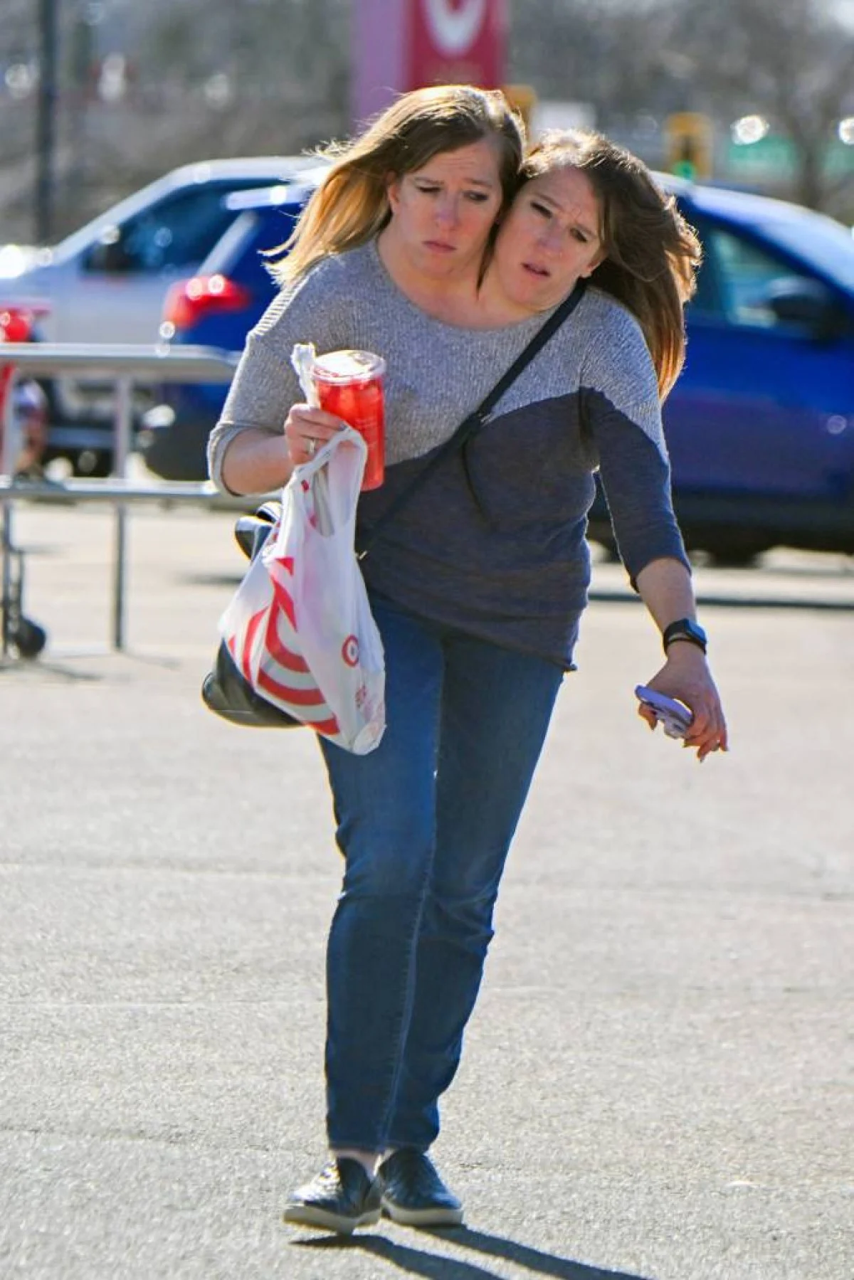 2025-11-26_21-01-29_877699-meylesokhan-ir conjoined-twin-sisters-abby-brittany-80155850