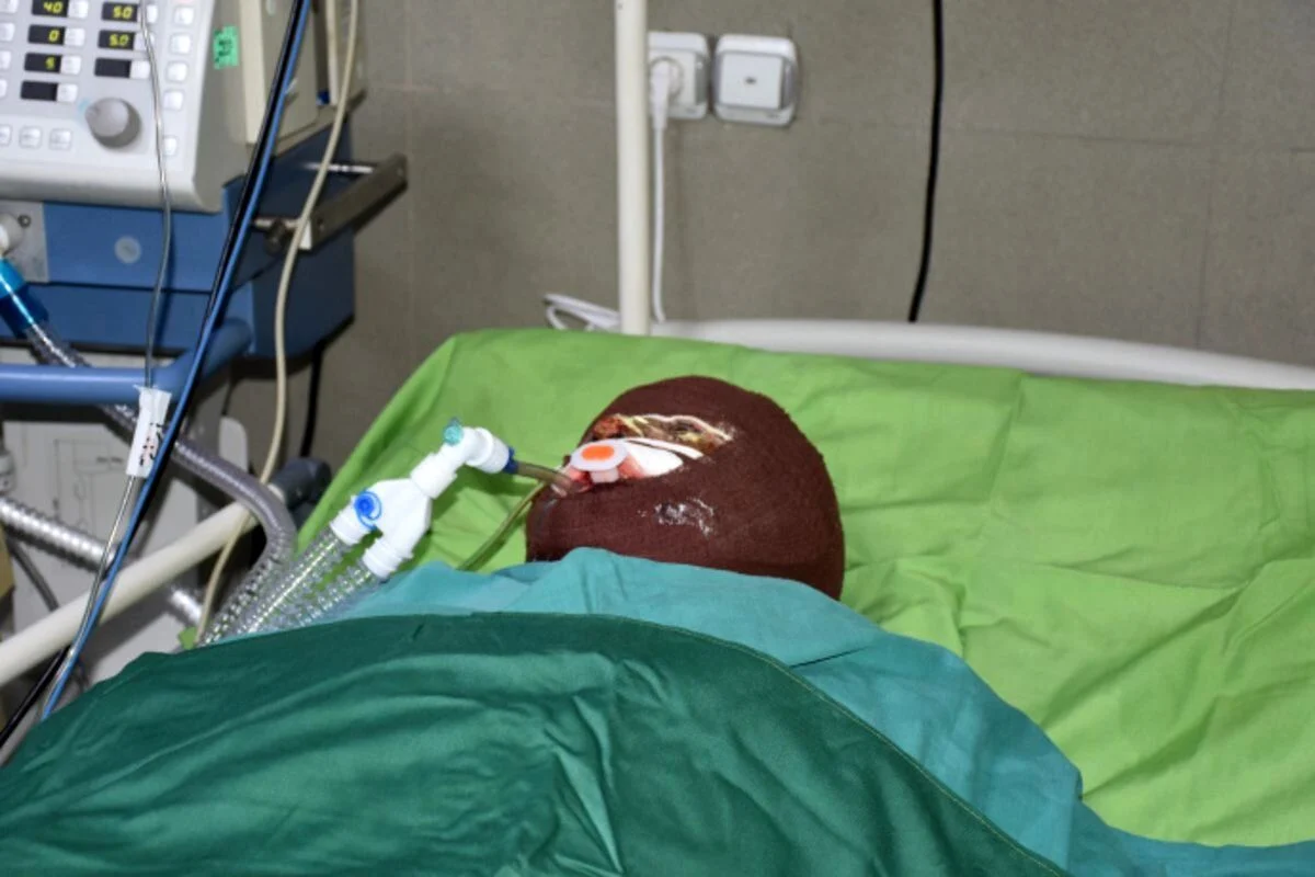 ماجرای اسیدپاشی هولناک روی پدر و دختر در تهران ماجرای اسیدپاشی هولناک روی پدر و دختر در تهران