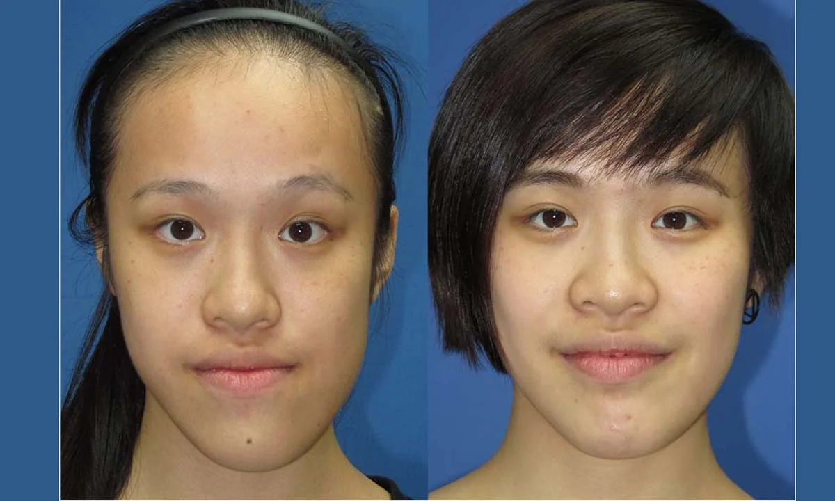 2025-12-03_18-42-46_453025-meylesokhan-ir مشکلات فک کج