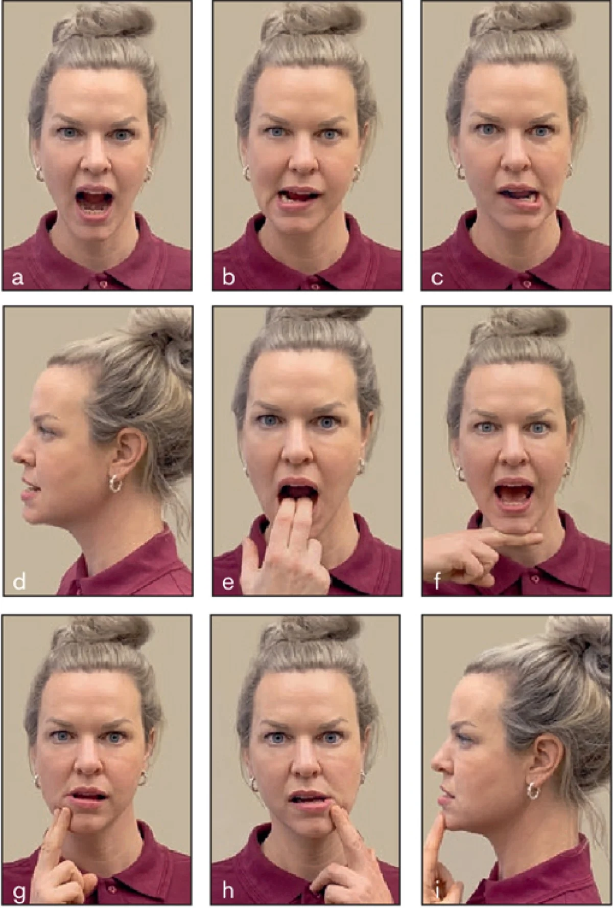 2025-12-03_18-42-51_594059-meylesokhan-ir درمان ناهنجاری فک با ورزش ممکن است؟