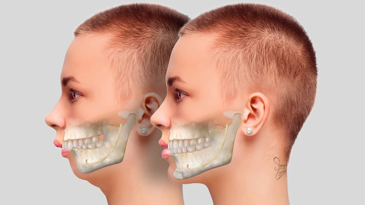 2025-12-03_18-42-52_165241-meylesokhan-ir ناهنجاری های رشد اسکلتی