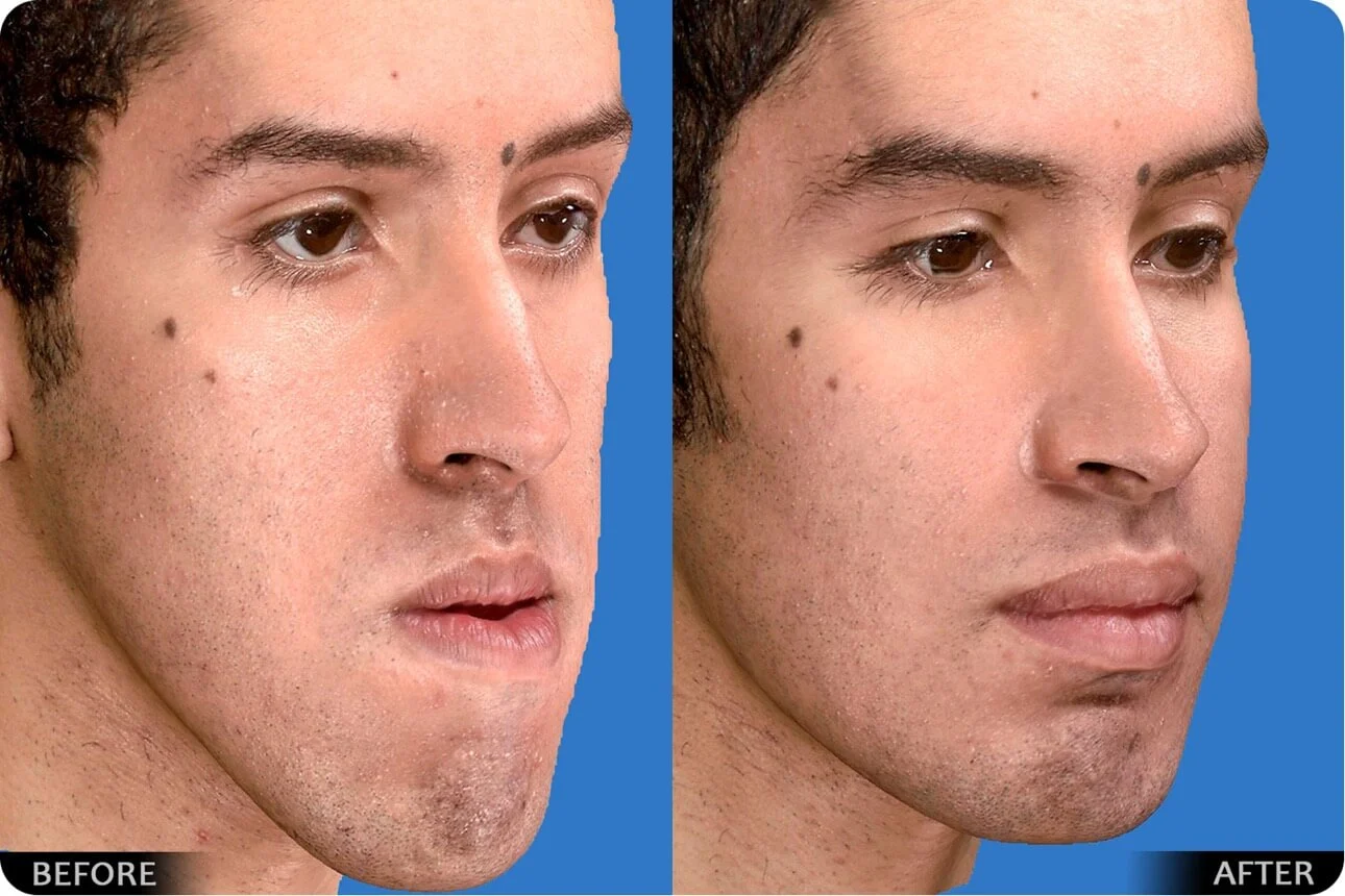 2025-12-03_18-42-52_840878-meylesokhan-ir مزایای درمان ناهنجاری فک بدون جراحی