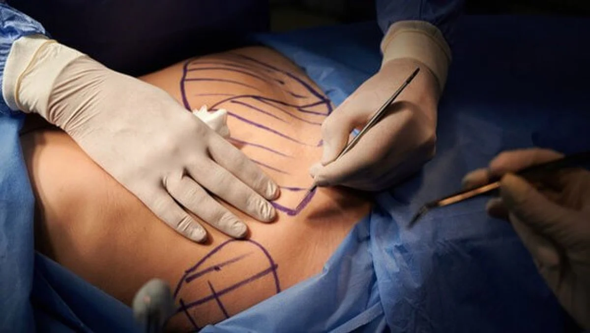 2025-12-03_20-32-15_113804-meylesokhan-ir عمل لیپوماتیک چیست؟