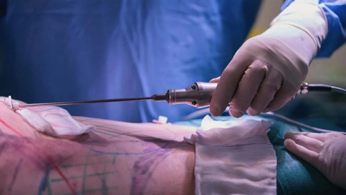 2025-12-03_20-32-18_252002-meylesokhan-ir اقدامات لازم قبل از عمل جراحی لیپوماتیک