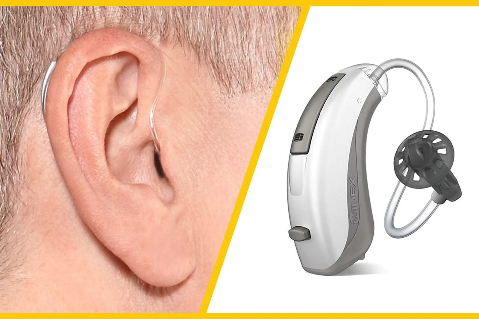 2025-12-04_08-21-15_611814-meylesokhan-ir سمعک پشت گوشی استاندارد (Standard BTE)