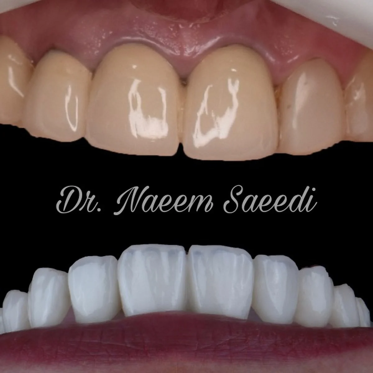 2025-12-04_08-26-15_230142-meylesokhan-ir لمینت دندان اقساطی +شرایط پیش پرداخت و قسط چیست؟