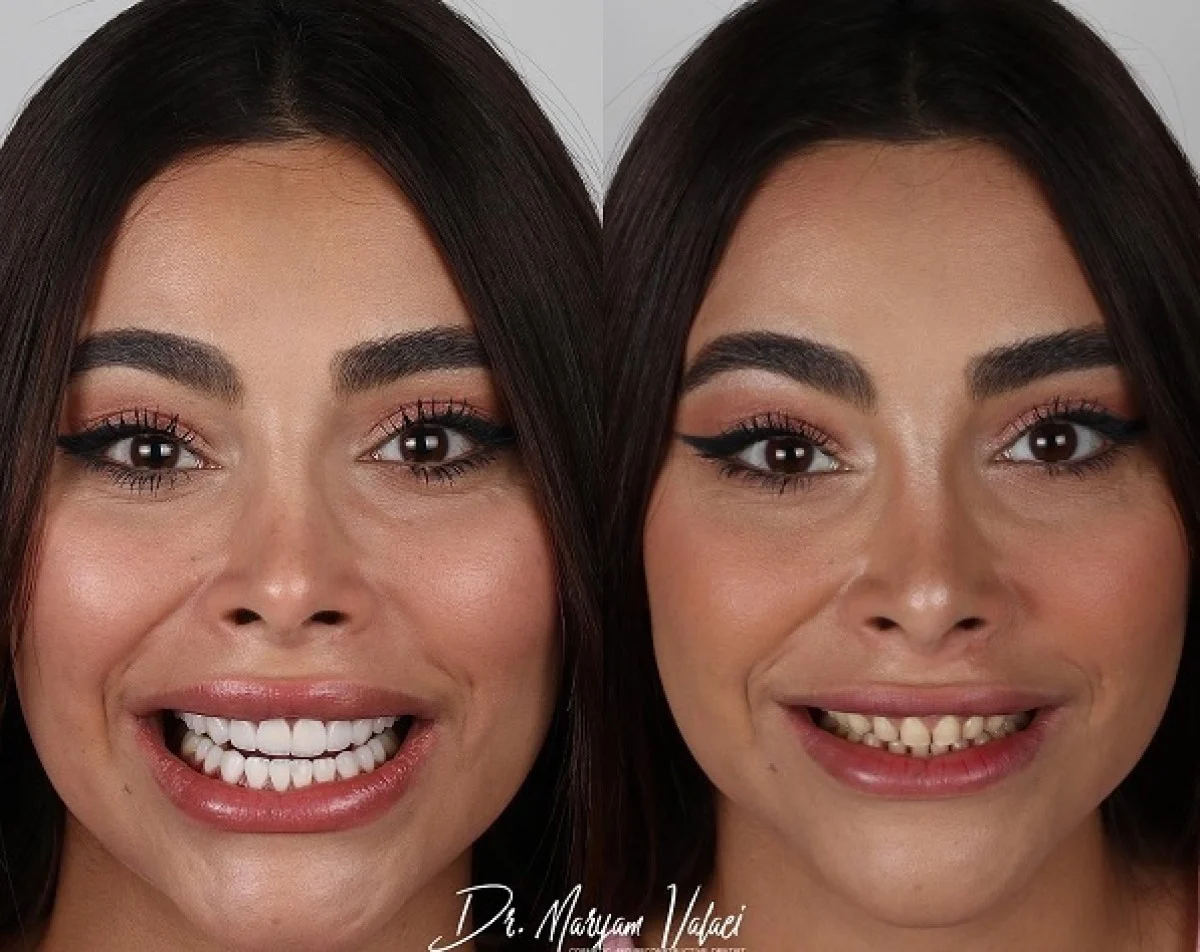 بهترین دندانپزشک زیبایی در تهران + لیست 10 دندانپزشک برتر