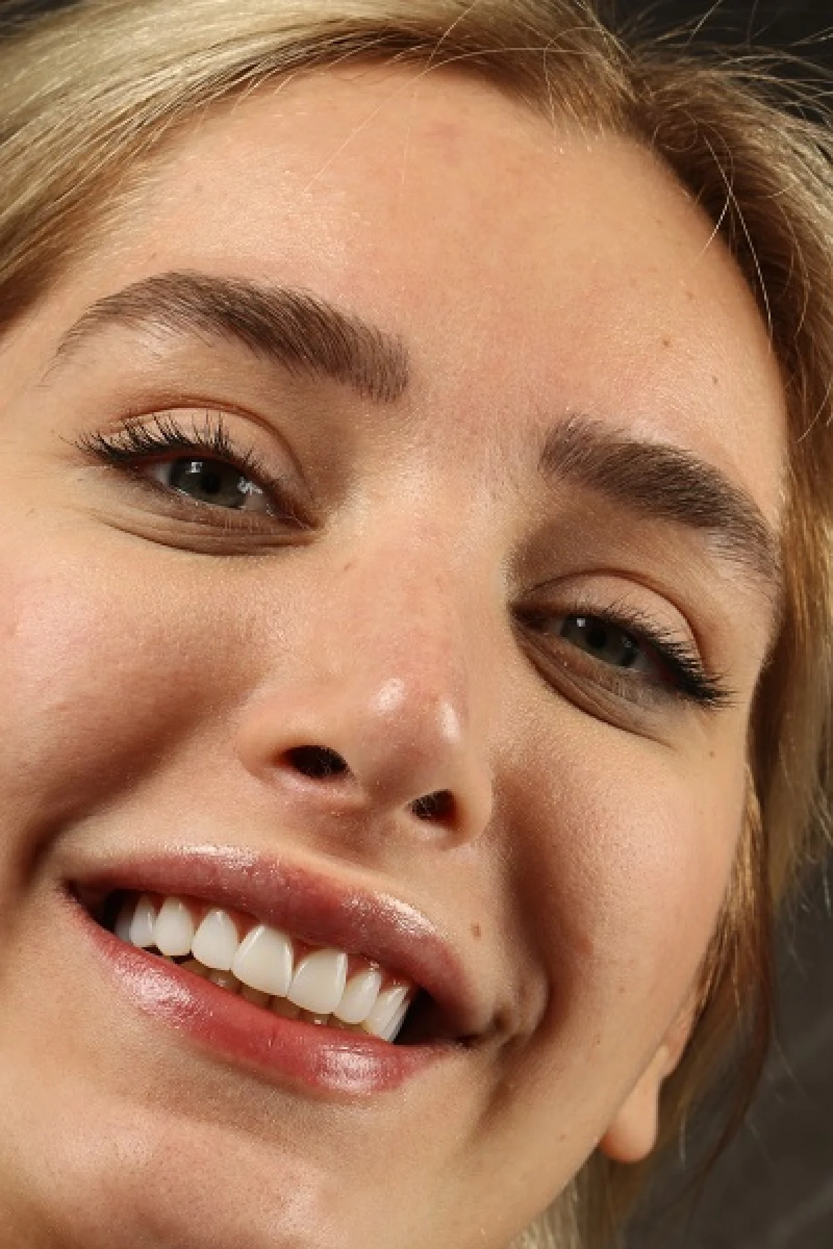 مزایای اجرای کامپوزیت ونیر چیست؟